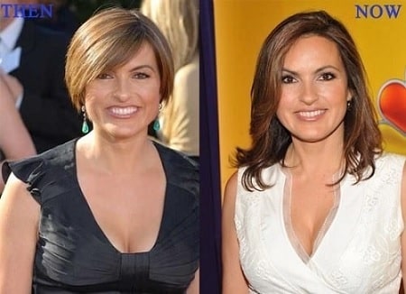 A picture of Mariska Hargitay before (left) and after (right).